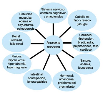 anorexia nerviosa